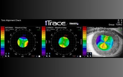 iTrace vs Pentacam AXL Wave